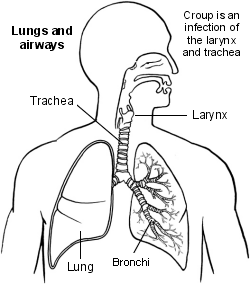 Lungs and airways croup